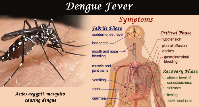 Dengue Fever Symptoms, Treatment & Prevention