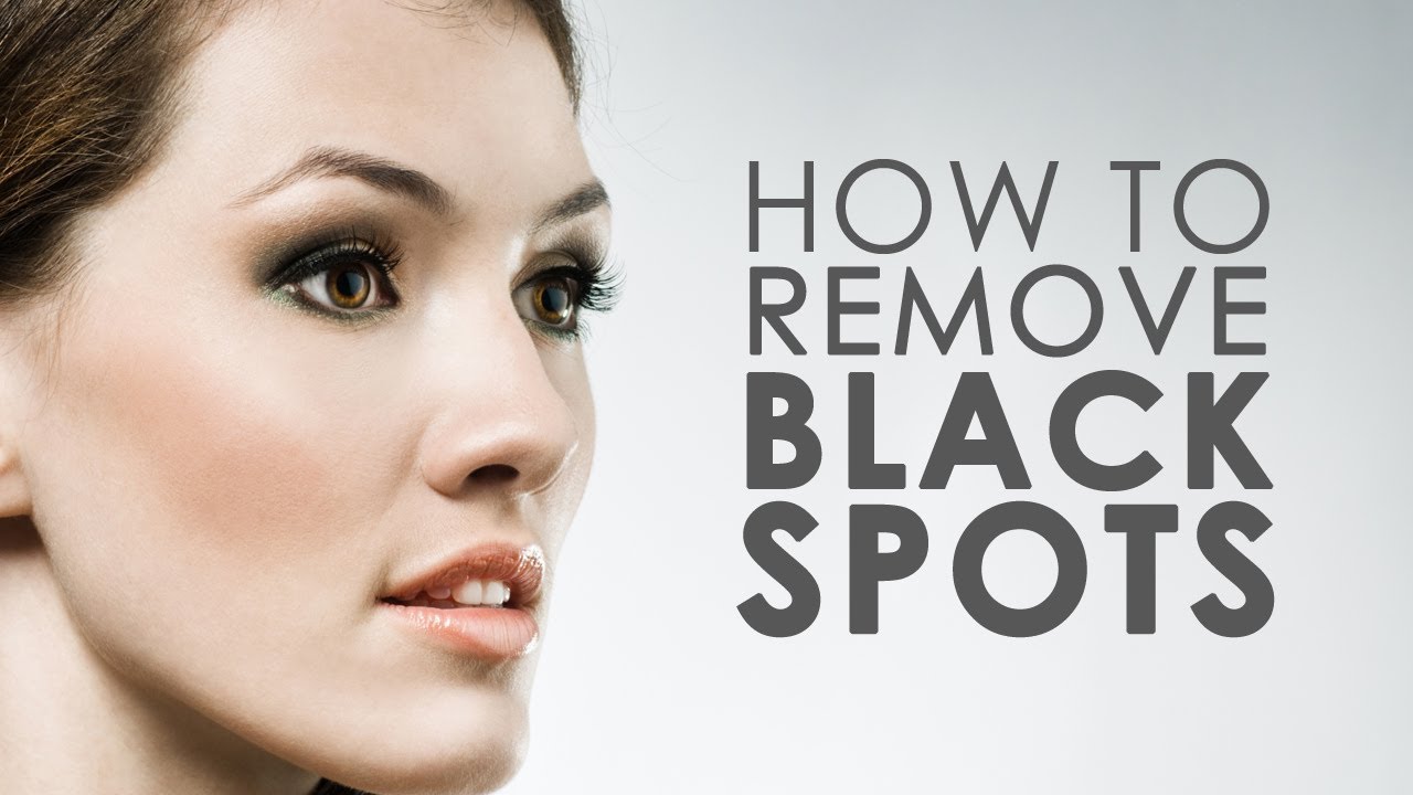 Dark Spots Removal Home Remedies | 5 Natural Ways To Remove Dark Spots