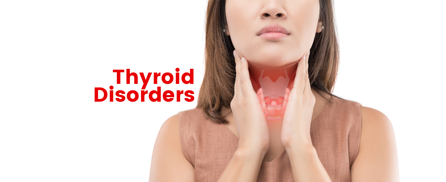 Thyroid Disorders in Women, Thyroid Symptoms, Diagnosis and Treatment